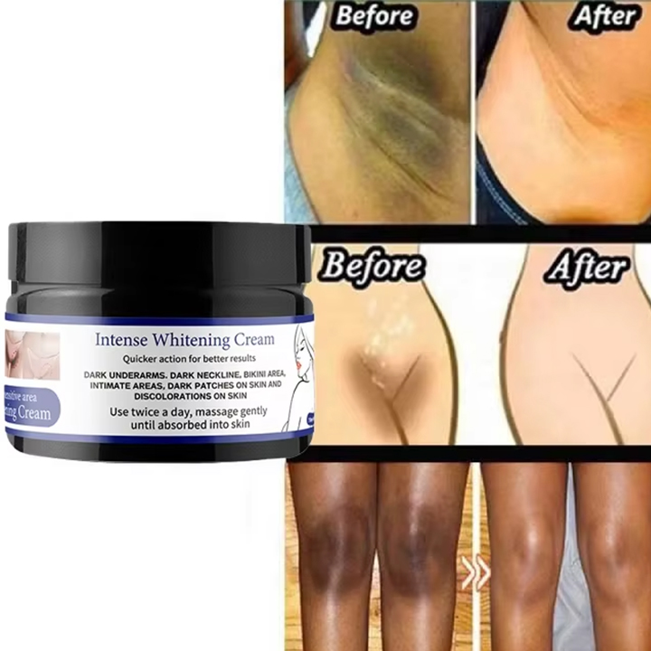 Intense whitening cream